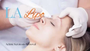 Woman receiving Actinic Keratosis Removal Treatment Hedge End
