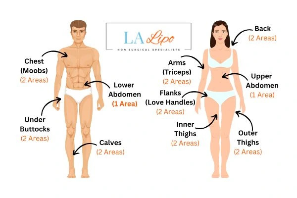 LA LIPO Cryolipolysis Areas Hedge End