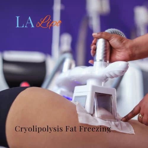 fat freezing - Cryolipolysis Hedge End