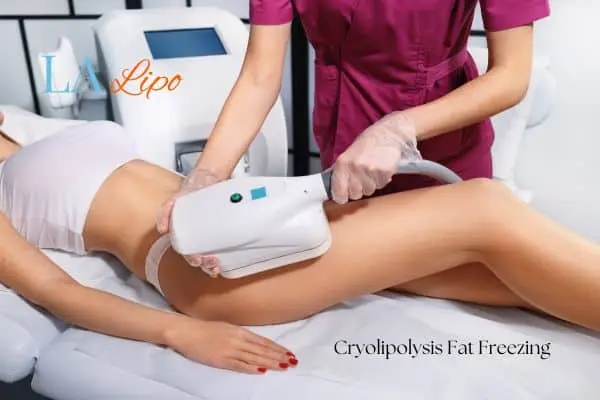 Woman receiving coolsculpting Hedge End treatment on her thighs