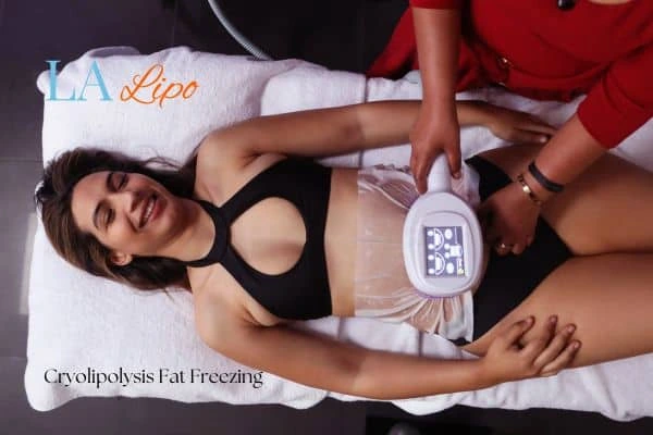 woman getting cryolipolysis Hedge End