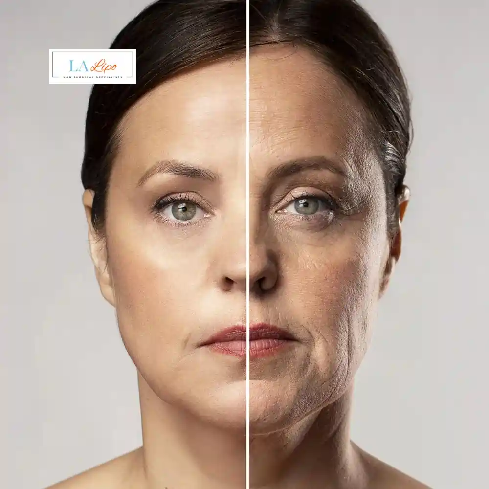 How Can You Tell If Non-Surgical Skin Tightening Is Right for You Hedge End?