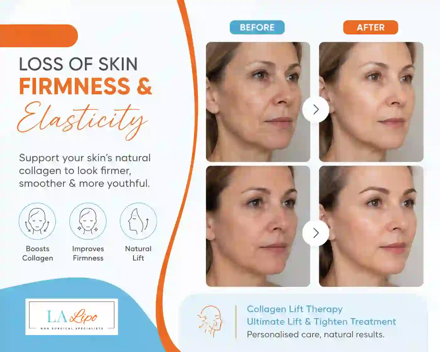 Sign #7: Loss of Skin Firmness and Elasticity Hedge End